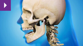 Jaw Joint Problems